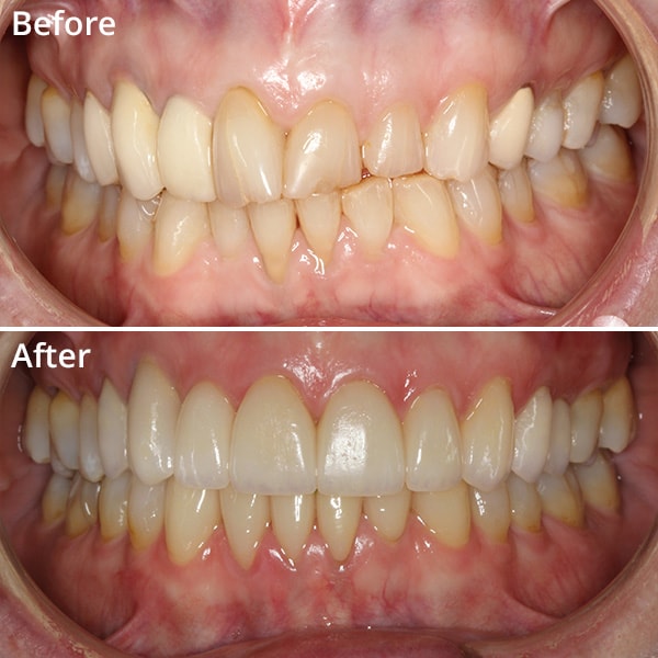 One of patients comparing their before and after images